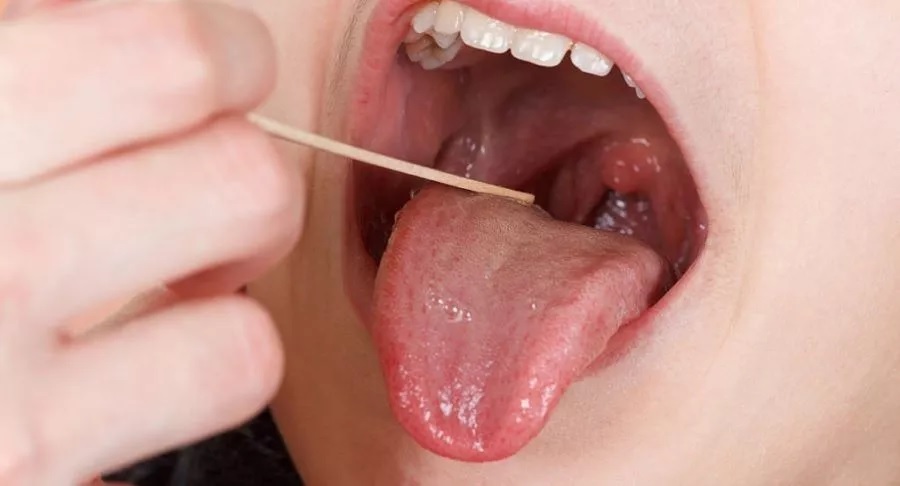 Treatments For Throat Lump Relief